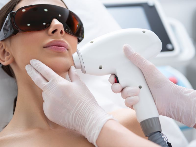 The Comprehensive Guide to Laser Hair Removal